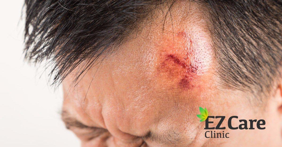 Minor wounds, cuts, and blisters - EzCare Clinic